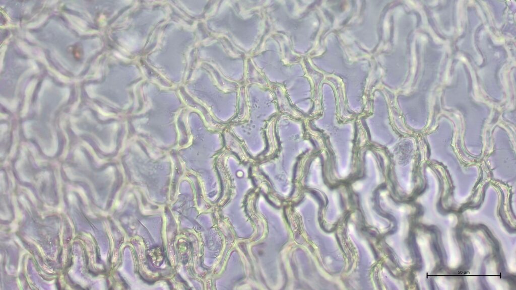 Stammblatt mit Kammfasern von Sphagnum affine