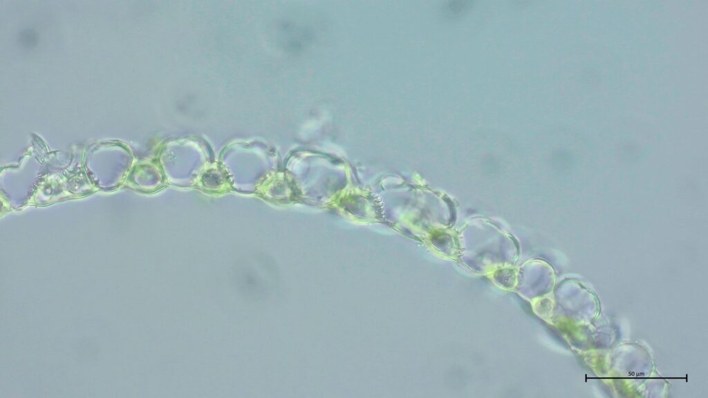 Astblattquerschnitt von Sphagnum affine