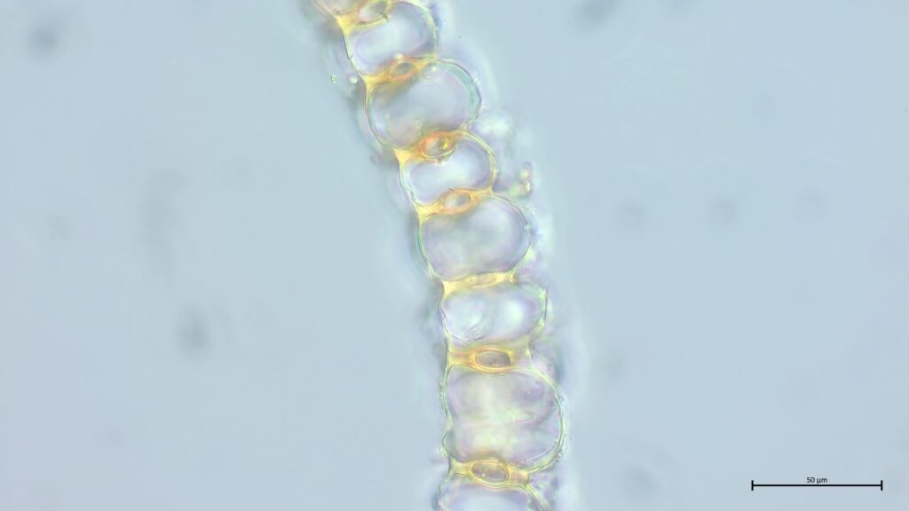 Sphagnum centrale Astblattquerschnitt