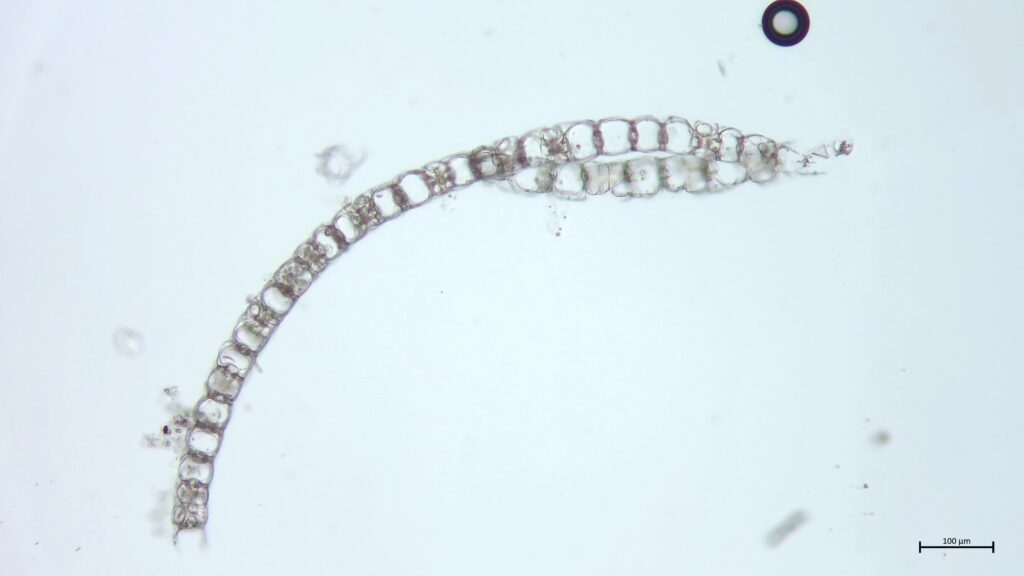 Sphagnum centrale Astblattquerschnitt