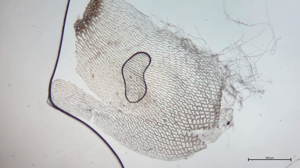 Sphagnum centrale Stammblatt