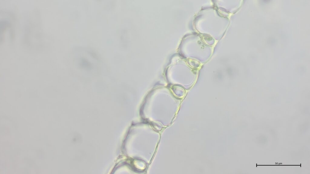 Sphagnum palustre Astblattquerschnitt