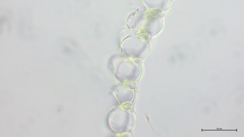 Sphagnum palustre Astblattquerschnitt