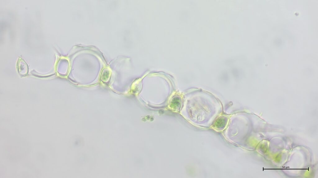 Sphagnum palustre Astblattquerschnitt