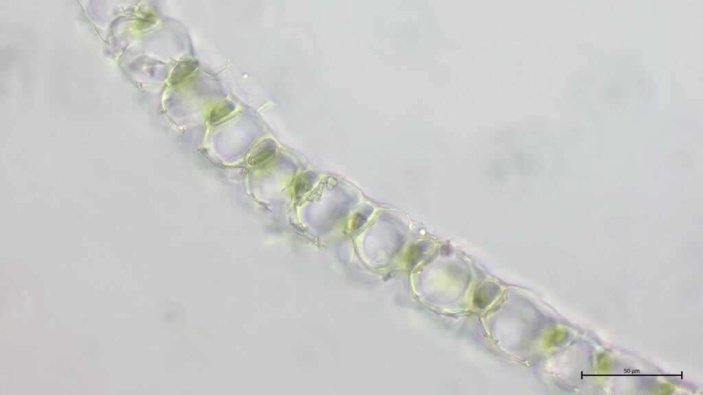 Sphagnum palustre Astblattquerschnitt
