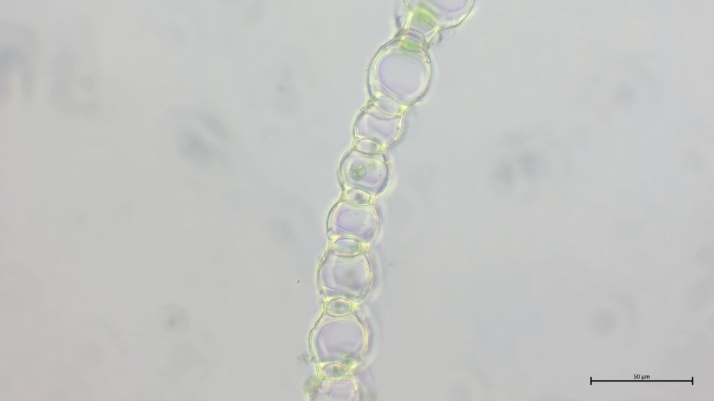 Sphagnum palustre Astblattquerschnitt