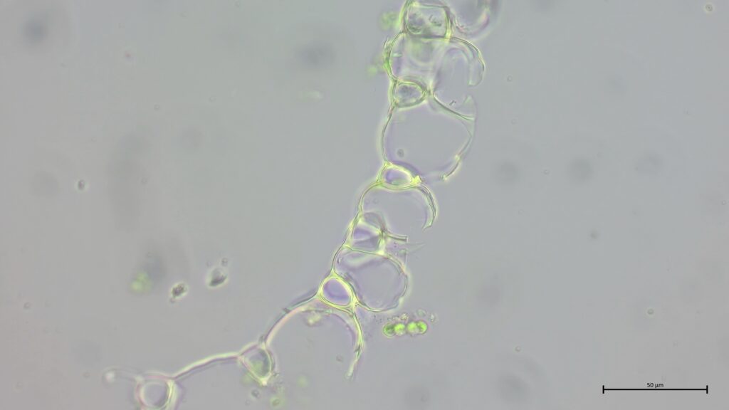 Sphagnum palustre Astblattquerschnitt
