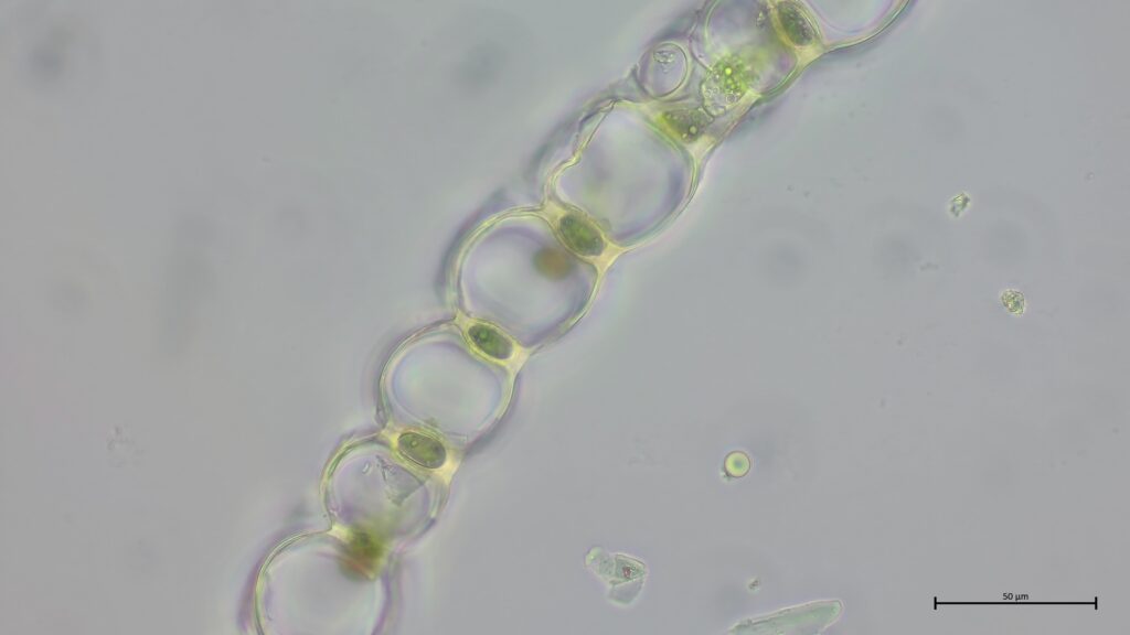 Sphagnum papillosum Astblattquerschnitt