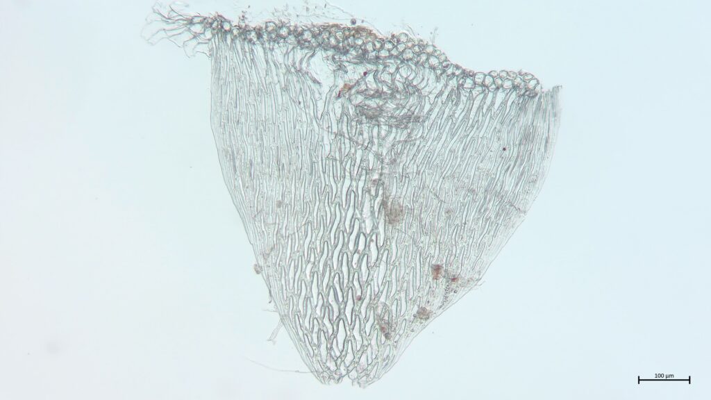 Stammblatt von Sphagnum angustifolium