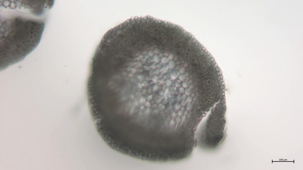 Stammquerschnitt von Sphagnum angustifolium