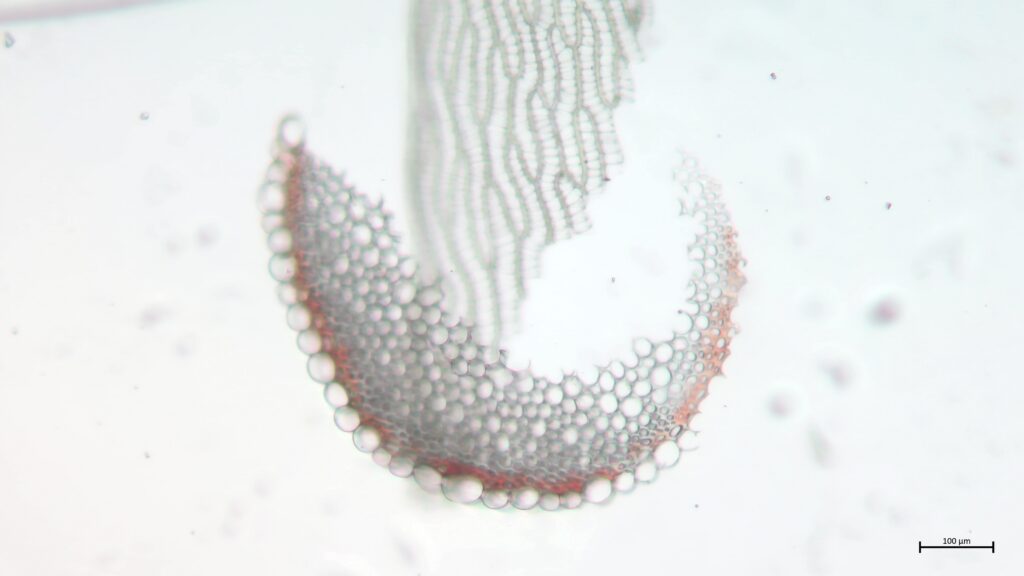 Stammquerschnitt von Sphagnum denticulatum