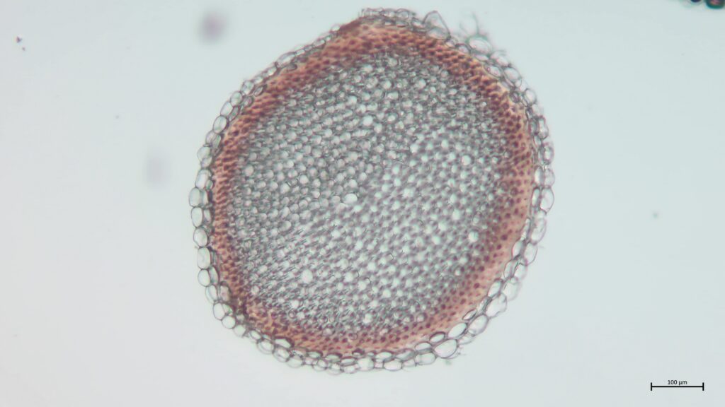 Stammquerschnitt von Sphagnum contortum