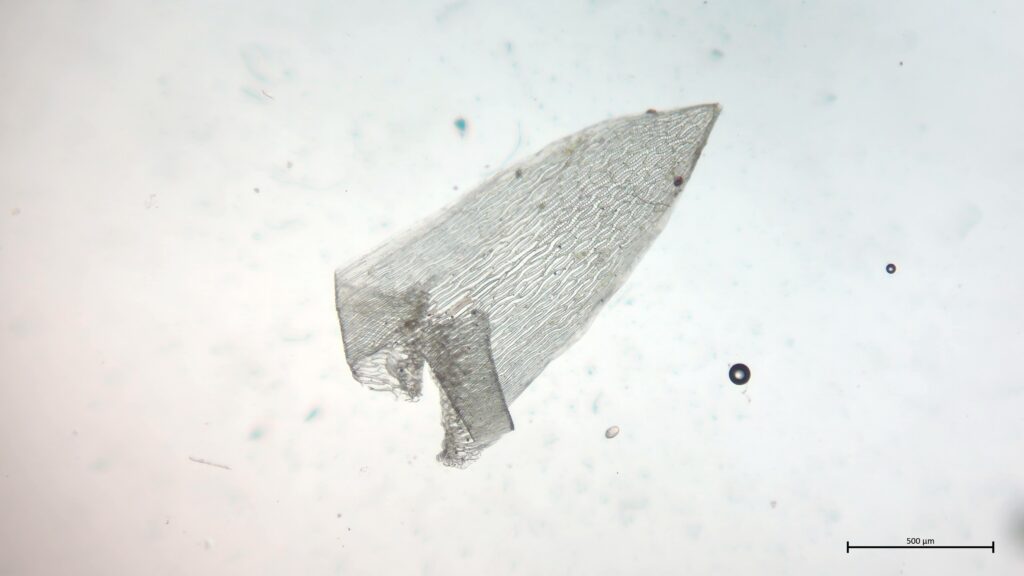 Stammblatt von Sphagnum cuspidatum