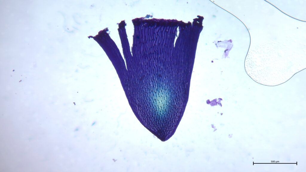 Stammblatt von Sphagnum cuspidatum