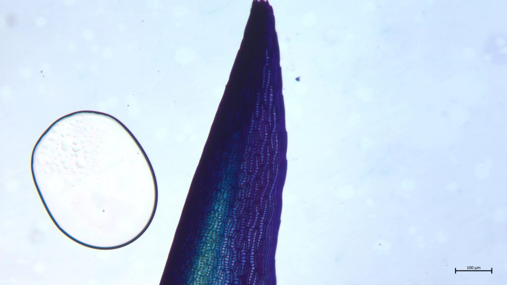 Astblatt von Sphagnum cuspidatum