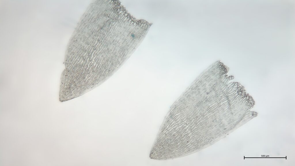 Stammblatt von Sphagnum cuspidatum
