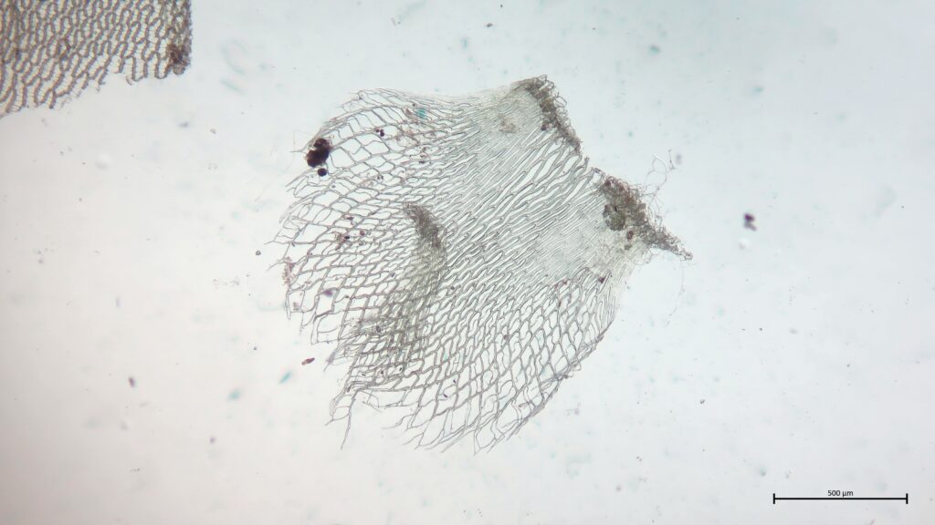 Stammblatt von Sphagnum fimbriatum
