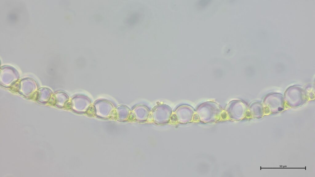 Astblattquerschnitt von Sphagnum flexuosum