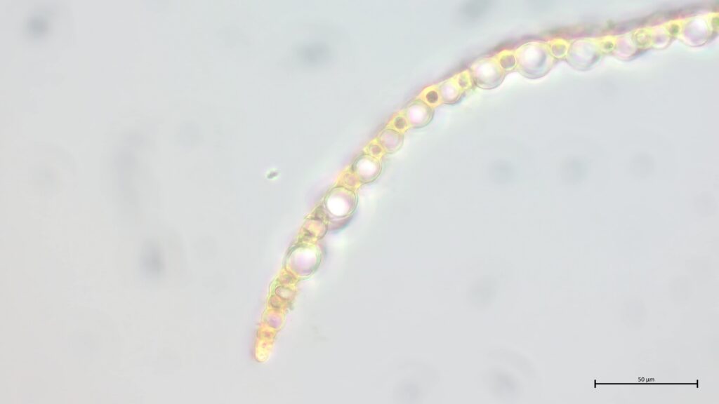 Astblattquerschnitt von Sphagnum flexuosum