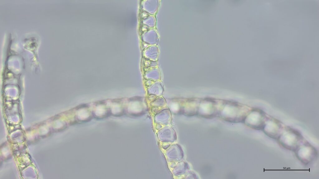Astblattquerschnitt von Sphagnum pulchrum