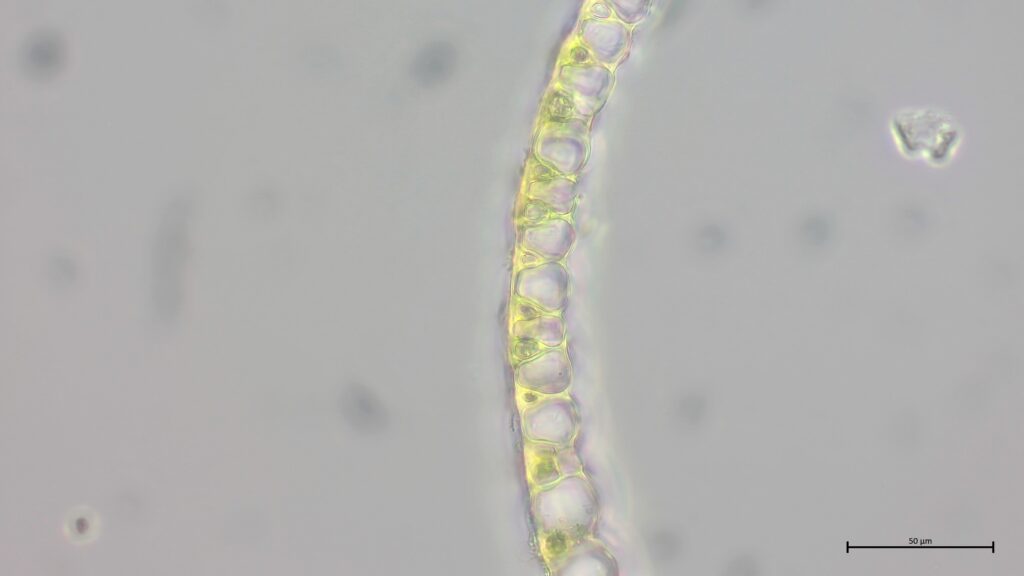 Astblattquerschnitt von Sphagnum pulchrum