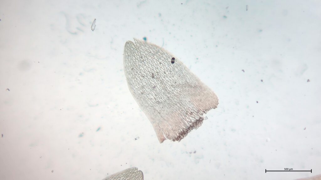 Stammblatt von Sphagnum rubellum