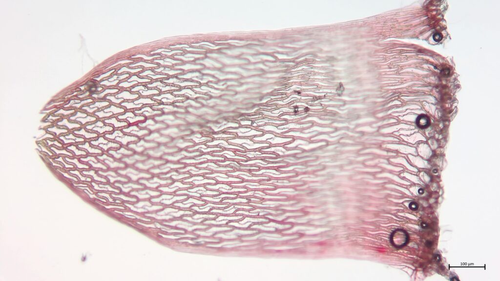 Stammblatt von Sphagnum rubellum