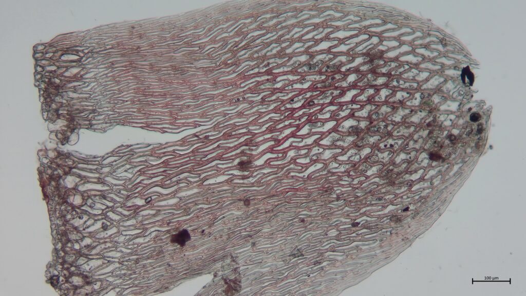 Stammblatt von Sphagnum russowii