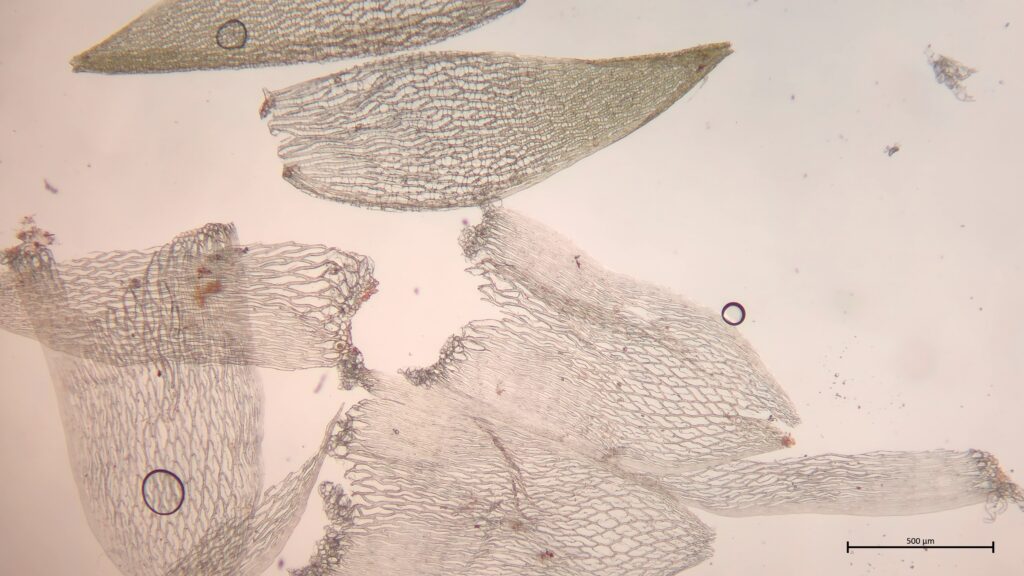 Ast- und Stammblätter von Sphagnum subnitens
