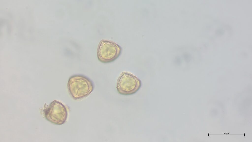 Sphagnum cuspidatum Sporen