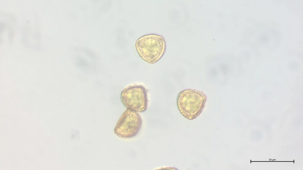 Sphagnum cuspidatum Sporen