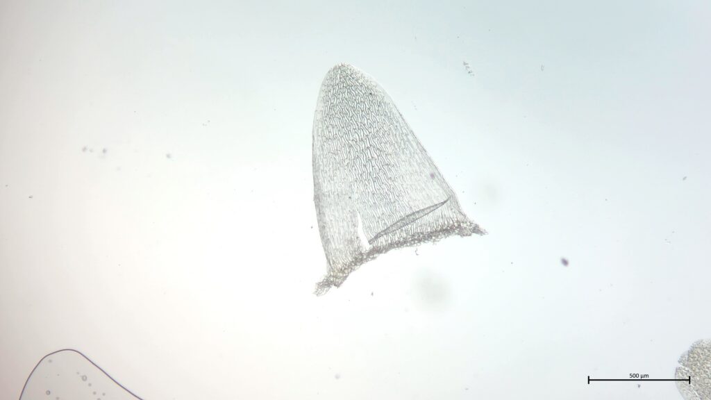 Sphagnum cuspidatum Stammblatt