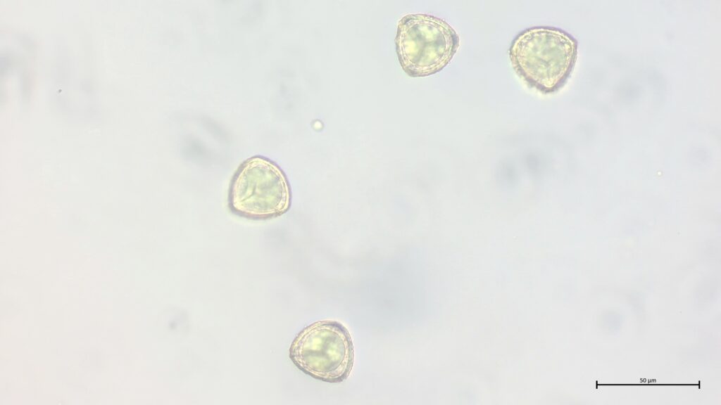 Sphagnum cuspidatum Sporen