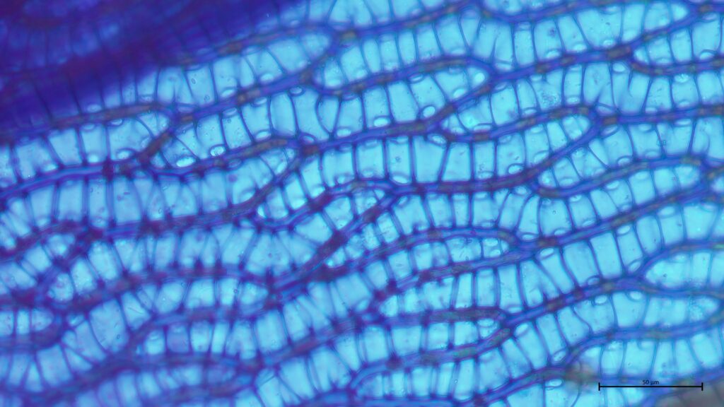Sphagnum denticulatum Astblattporen