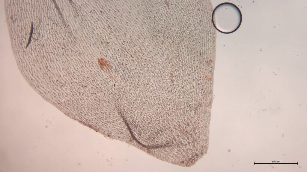 Stammblatt von Sphagnum denticulatum