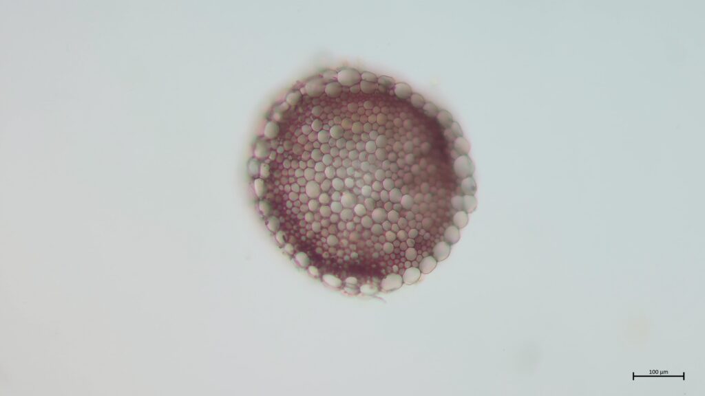 Stammquerschnitt von Sphagnum denticulatum