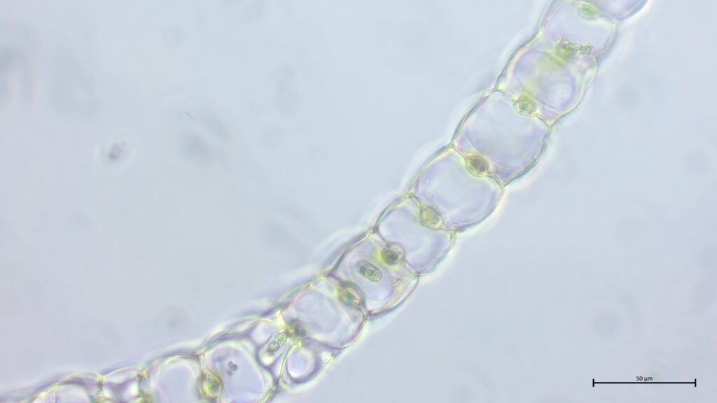 Sphagnum divinum Astblattquerschnitt