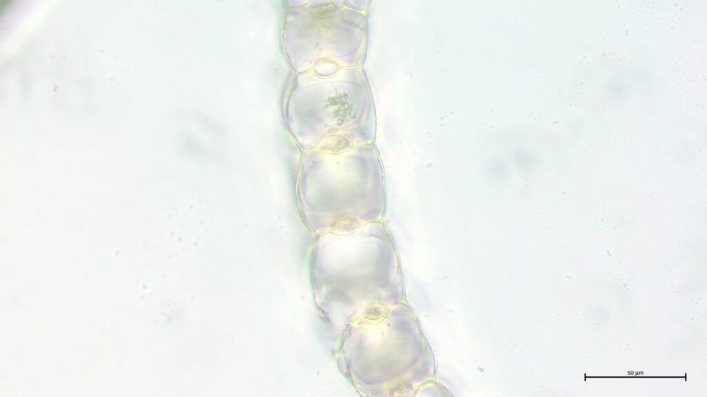 Sphagnum divinum Astblattquerschnitt