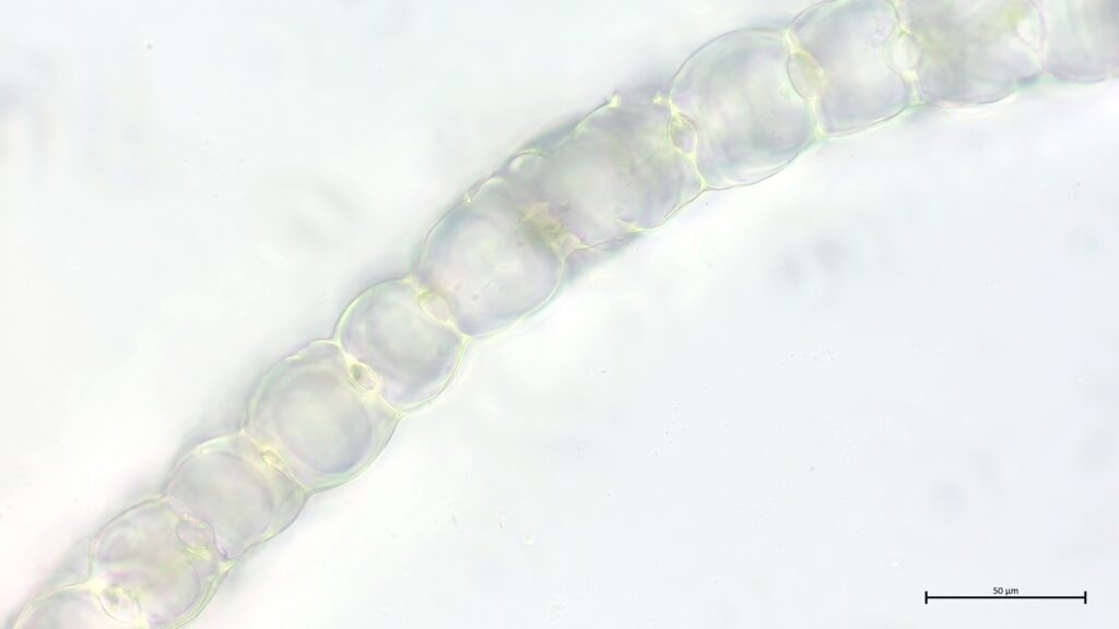 Sphagnum divinum Astblattquerschnitt