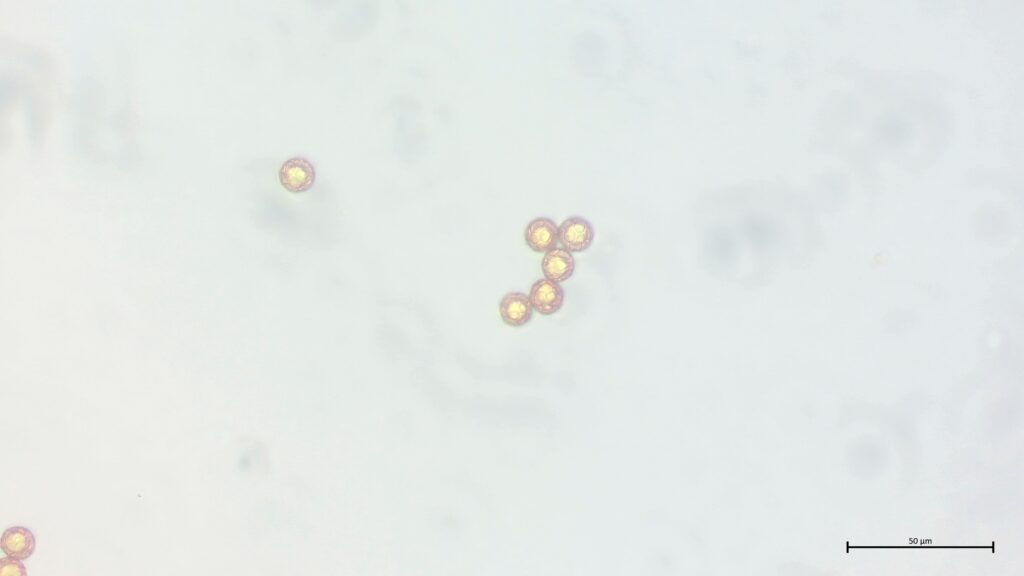 Sphagnum fimbriatum Sporen