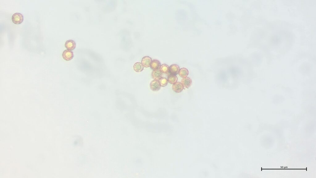 Sphagnum fimbriatum Sporen