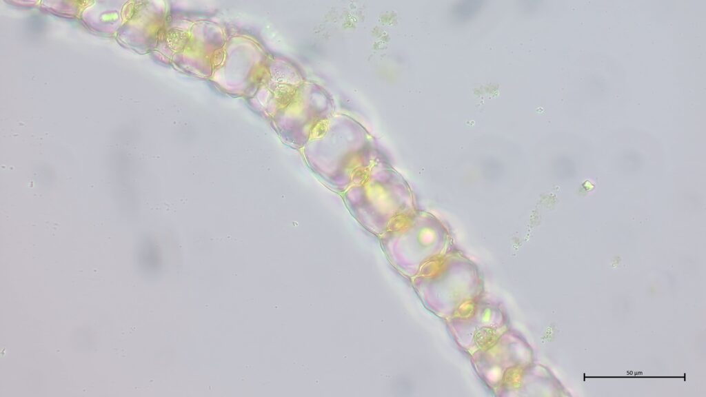 Sphagnum medium Astblattquerschnitt