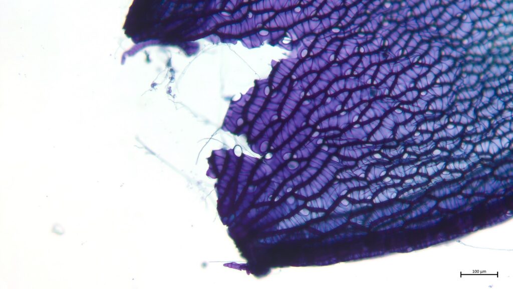 Sphagnum medium Astblatt Poren