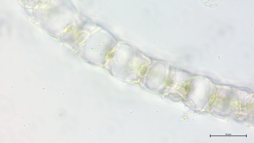 Sphagnum medium Astblattquerschnitt
