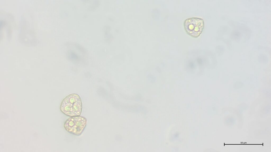 Sporen von Sphagnum squarrosum