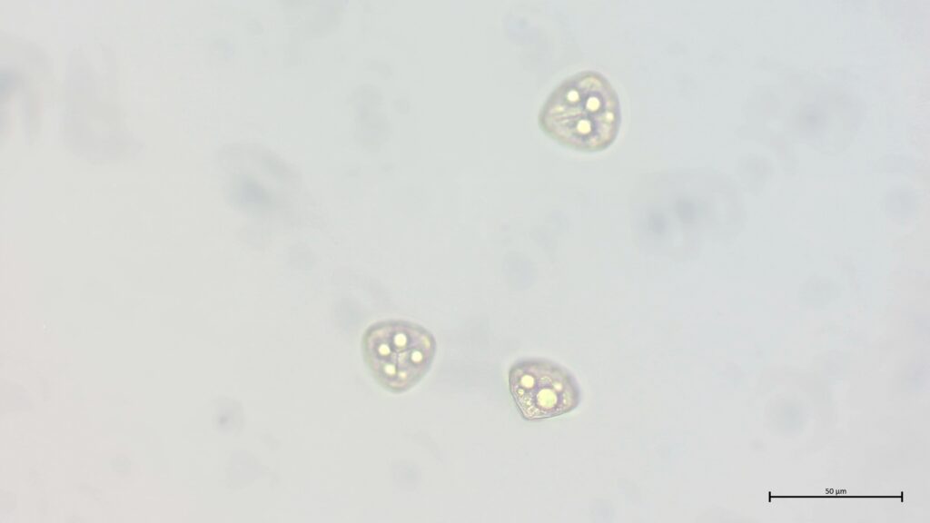 Sporen von Sphagnum squarrosum