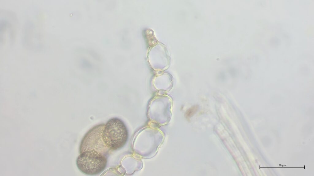 Astblattquerschnitt von Sphagnum capillifolium