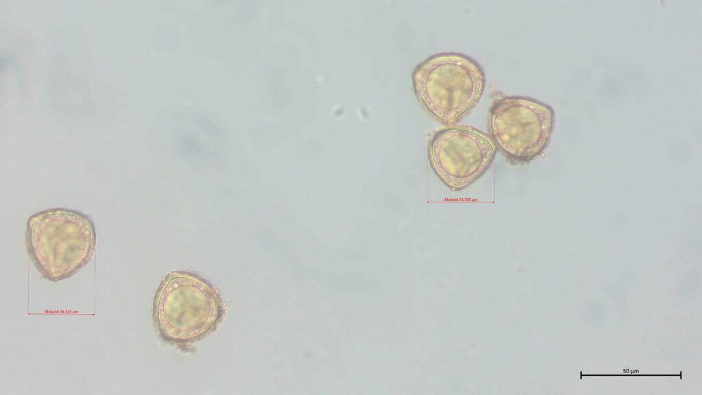 Sphagnum cuspidatum Sporen