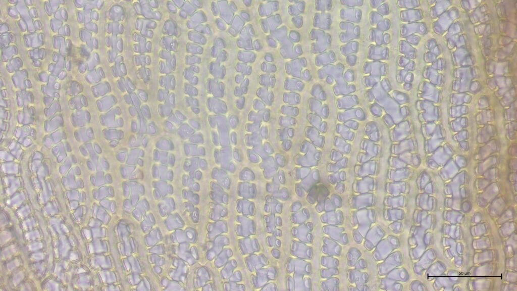 Sphagnum denticulatum Astblattporen