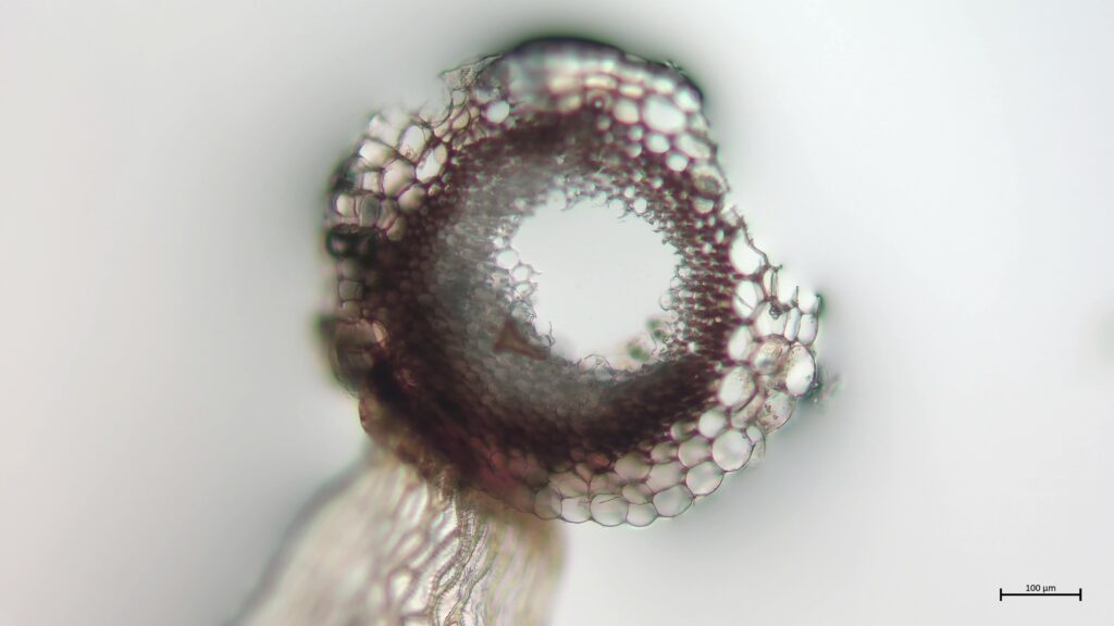 Stammquerschnitt von Sphagnum lindbergii